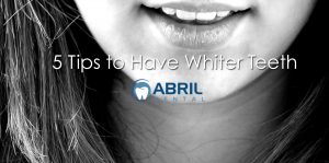 5 tips to have whiter teeth