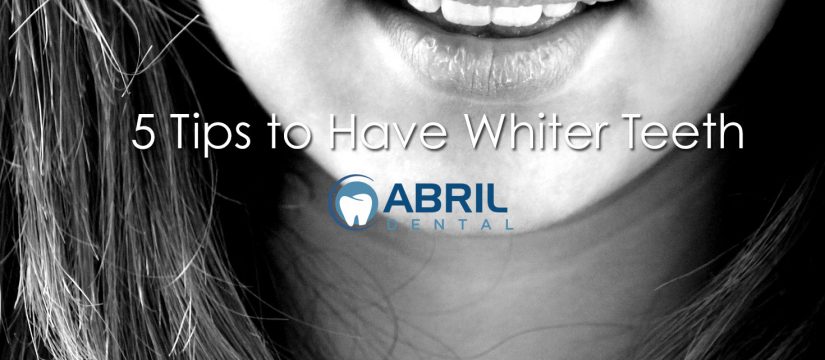 5 tips to have whiter teeth