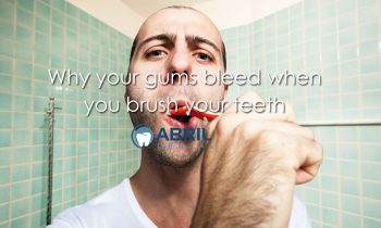 Why your gums bleed when you brush your teeth