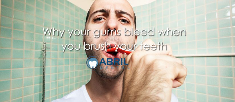 Why your gums bleed when you brush your teeth