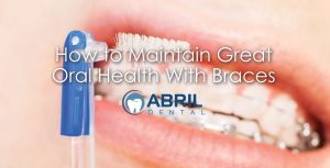 How to Maintain Great Oral Health With Braces