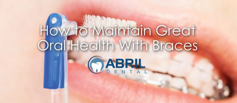 How to Maintain Great Oral Health With Braces