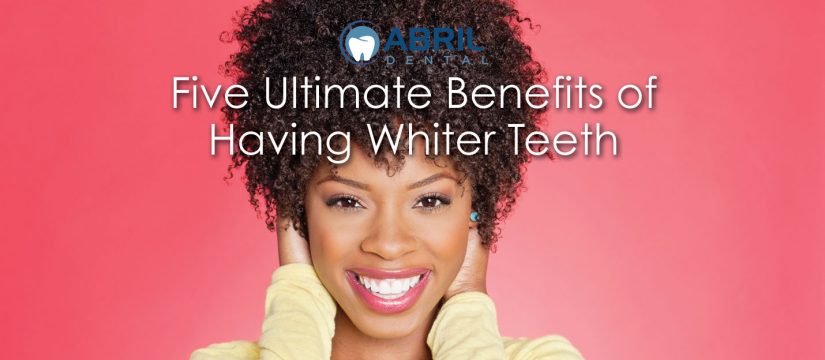 Five Ultimate Benefits of Having Whiter Teeth