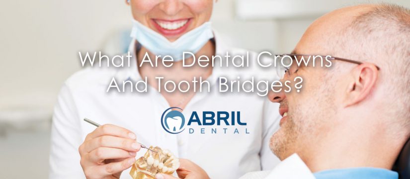 dental-crowns-tooth-bridges